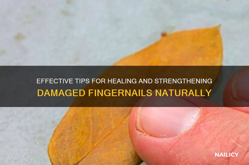 how to heal fingernails
