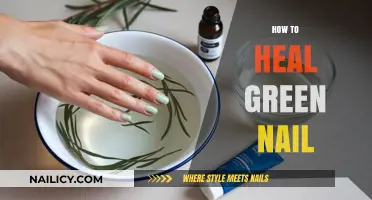 Effective Remedies to Heal and Restore Your Green Nails Fast