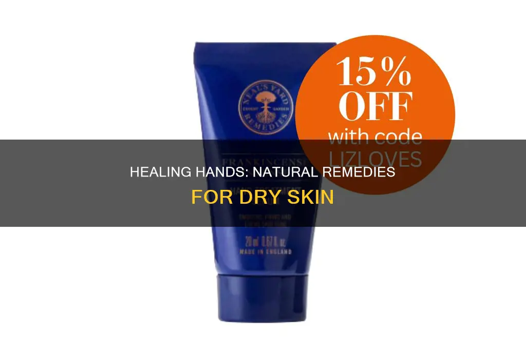 how to heal hands dried by nail polish remover