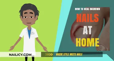 Effective Home Remedies to Heal Painful Ingrown Nails Quickly and Safely