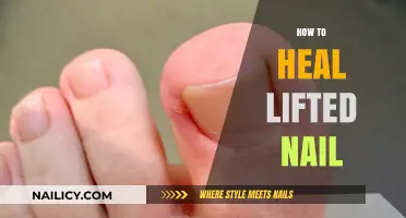 Effective Ways to Heal a Lifted Nail: Tips and Remedies