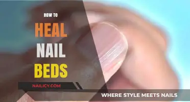Effective Tips for Healing Damaged Nail Beds Naturally and Quickly