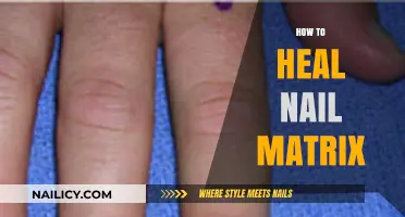 Heal Your Nail Matrix: Effective Tips for Healthy Nail Growth