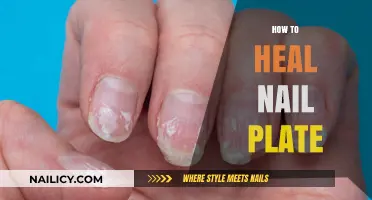 Effective Nail Plate Healing: Tips for Stronger, Healthier Nails