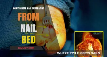 Heal Nail Separation: Effective Remedies for Nail Bed Repair