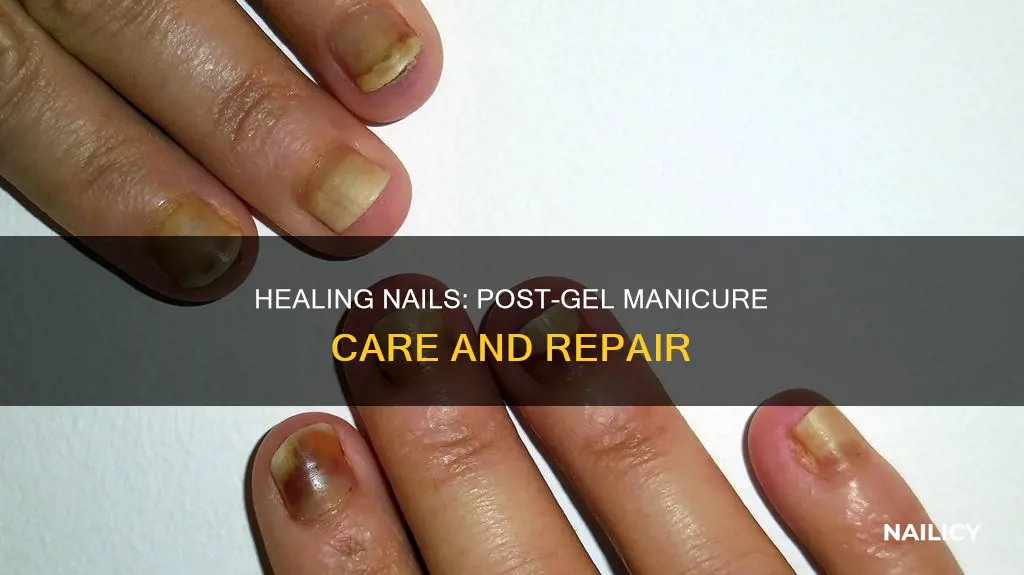 how to heal nails after gel manicure