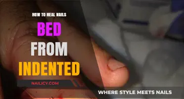 Effective Tips to Repair and Restore Indented Nail Beds Naturally