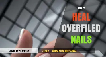 Healing Overfiled Nails: Gentle Care Tips for Strong, Healthy Recovery