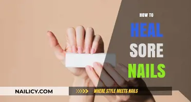 Effective Remedies to Soothe and Repair Sore, Damaged Nails Fast