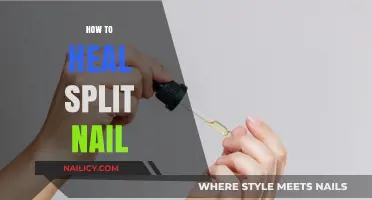 Effective Remedies to Repair and Heal a Split Nail Fast