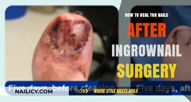 Healing Toenails Post-Ingrown Surgery: A Step-by-Step Recovery Guide