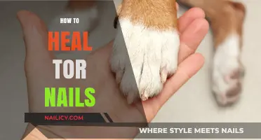 Effective Tips to Heal Torn Nails and Restore Nail Health