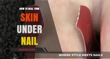 Healing Torn Skin Under Nails: Quick Remedies and Care Tips