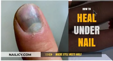 Effective Ways to Heal an Under-Nail Injury Fast and Safely