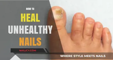 Revive Your Nails: Effective Tips to Heal and Strengthen Unhealthy Nails