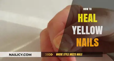 Restore Healthy Nails: Effective Tips to Heal Yellow Discoloration Fast