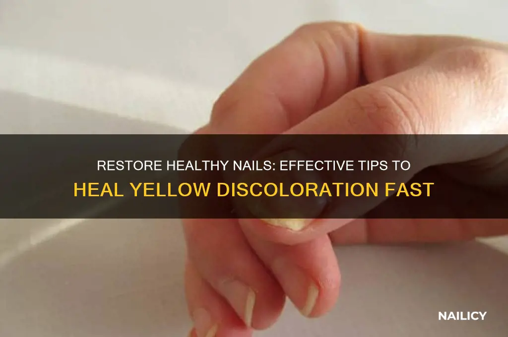 how to heal yellow nails