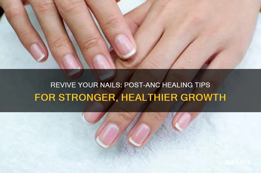 how to heal your nails after anc