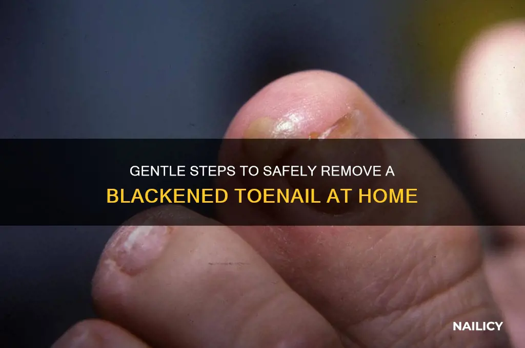 how to help a black nail fall off