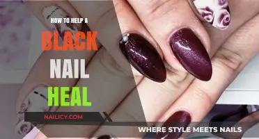 Healing a Black Nail: Effective Tips for Recovery and Care