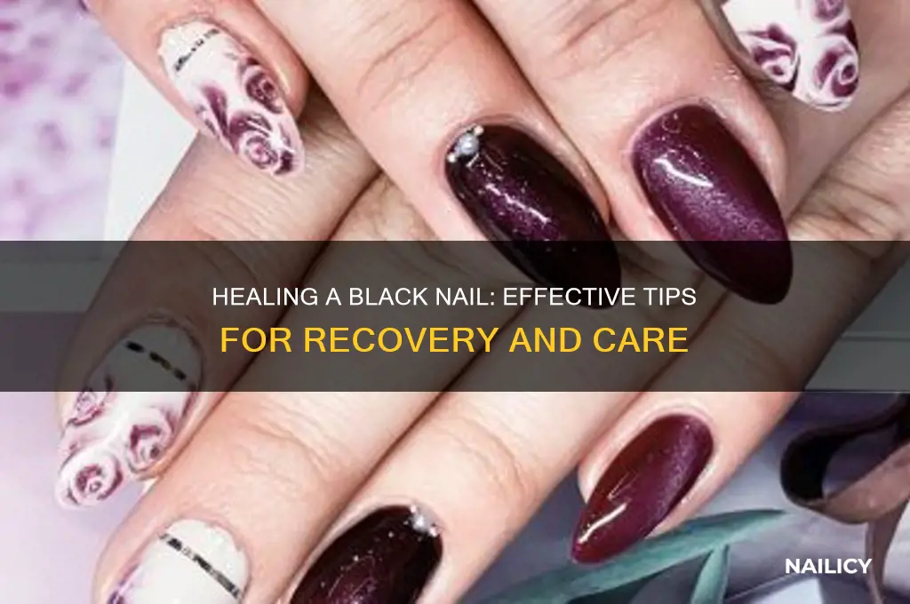 how to help a black nail heal