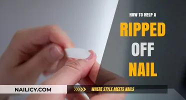 Quick Fixes for a Ripped Nail: Easy Repair and Care Tips