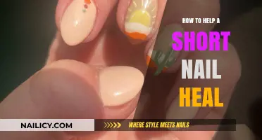 Healing Short Nails: Quick Tips for Healthy Growth and Strength