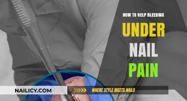 Relieve Bleeding Under Nail Pain: Quick and Effective Home Remedies