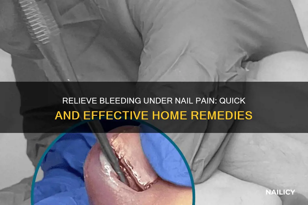 how to help bleeding under nail pain