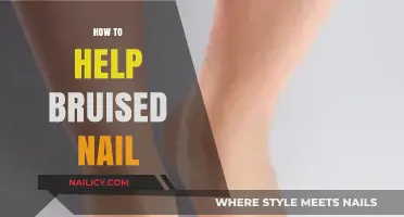 Heal and Restore: Effective Tips for Treating a Bruised Nail