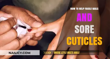 Nourish Fragile Nails & Soothe Sore Cuticles: Simple Care Tips
