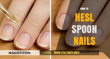 How to Heal Spoon Nails: Effective Remedies and Care Tips