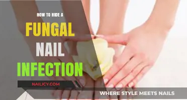 Conceal Fungal Nail Infections: Effective Tips for Discreet Nail Care