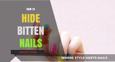 Conceal Bitten Nails: Quick Tips for Flawless, Healthy-Looking Hands
