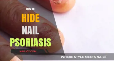 Concealing Nail Psoriasis: Effective Tips for a Flawless Manicure