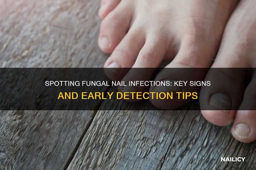 how to identify fungal nail