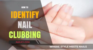 Recognizing Nail Clubbing: A Guide to Identifying This Key Symptom