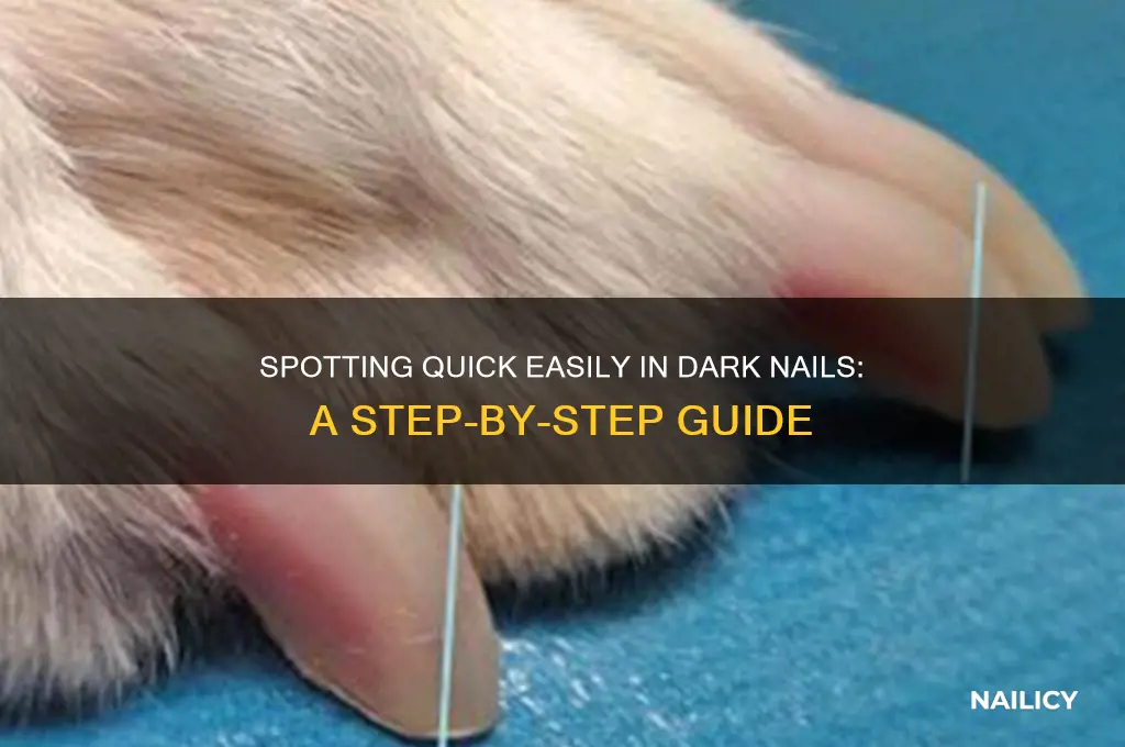 how to identify quick in dark nails