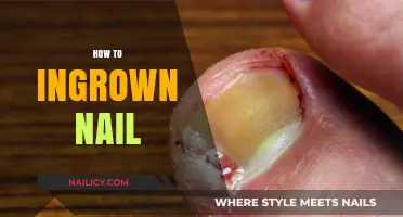 Effective Tips to Prevent and Treat Painful Ingrown Toenails