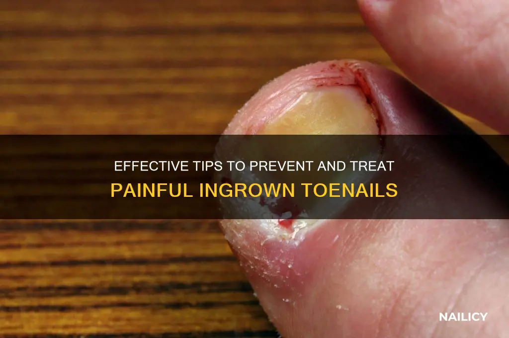how to ingrown nail