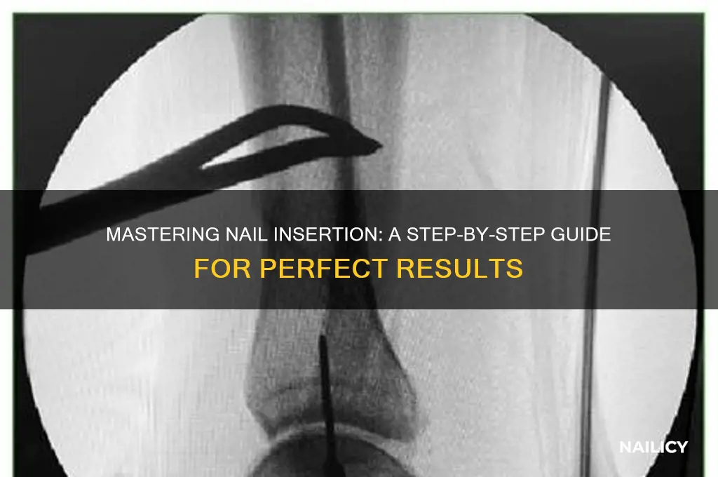 how to inset nails