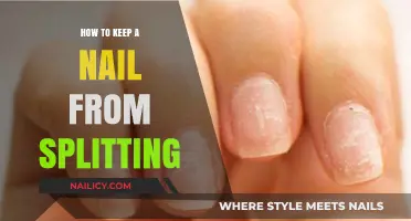 Prevent Nail Splitting: Essential Tips for Strong, Healthy Nails