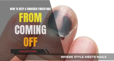 Keep Your Smashed Fingernail Intact: Tips and Tricks