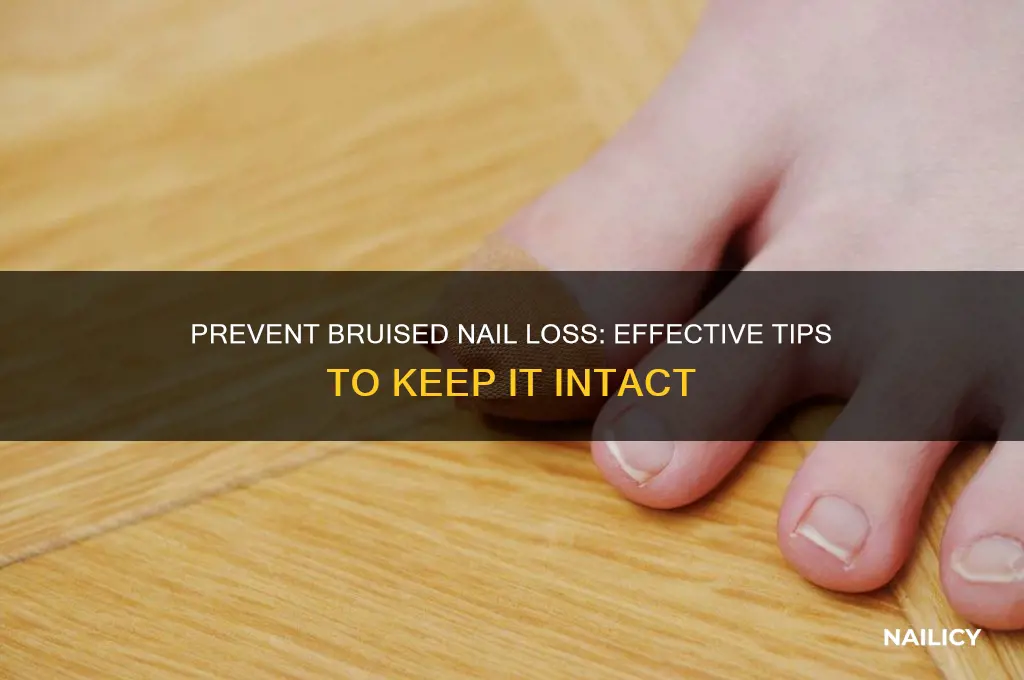 how to keep bruised nail from falling off