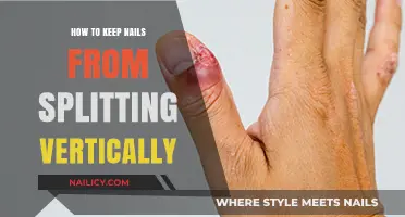 Prevent Vertical Nail Splits: Essential Tips for Strong, Healthy Nails