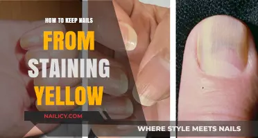 Prevent Yellow Nails: Tips for Keeping Your Nails Stain-Free and Healthy