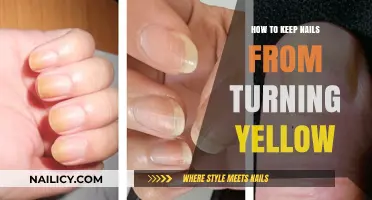 Prevent Yellow Nails: Tips for Healthy, Bright Manicures Naturally