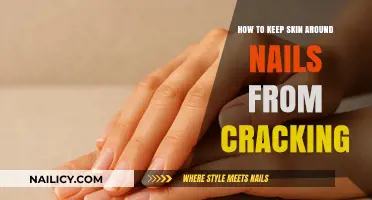 Prevent Cracked Cuticles: Essential Tips for Healthy Nail Skin
