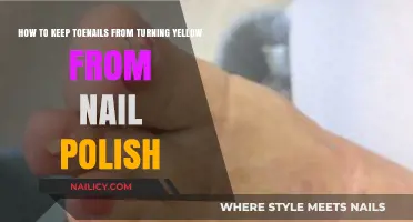 Prevent Yellow Toenails: Tips for Healthy, Polish-Protected Nails