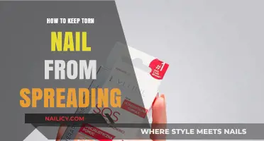 Prevent Torn Nail Spread: Quick Tips for Healthy Nail Recovery